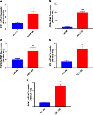 Bioinformatics-Guided Analysis Uncovers AOX1 as an Osteogenic Differentiation-Relevant Gene of Human Mesenchymal Stem Cells